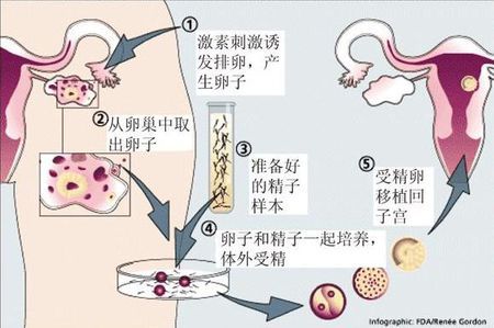 素竹生殖医学中心